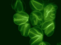 La utopía toxoplasmática de la vida