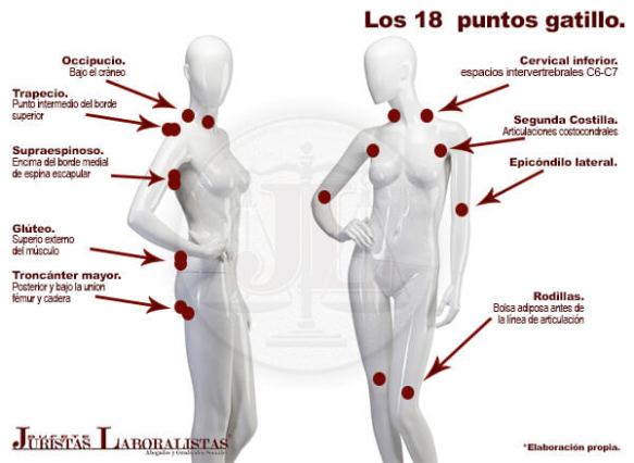 La fibromialgia: una entidad huérfana (II)
